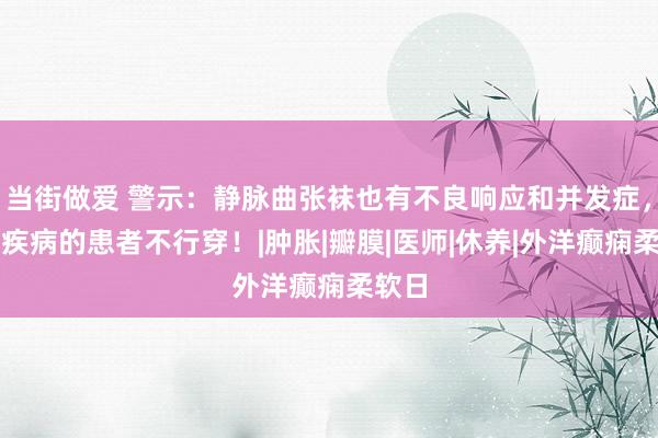 当街做爱 警示：静脉曲张袜也有不良响应和并发症，这些疾病的患者不行穿！|肿胀|瓣膜|医师|休养|外洋癫痫柔软日